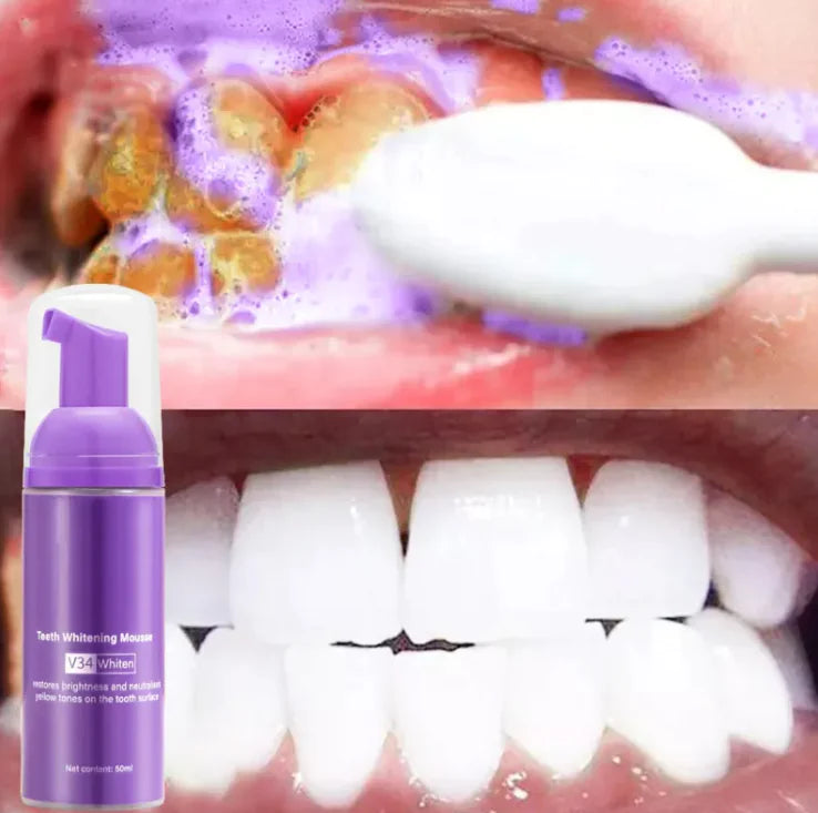 Smoke Stain Removal Teeth Mousse advanced mousse formula stubborn smok